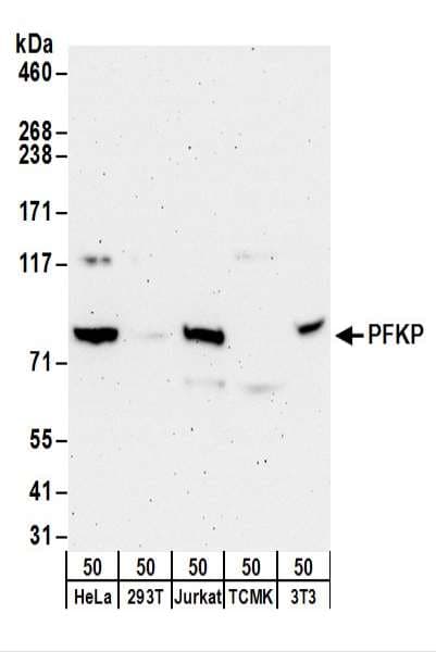 Polyclonal Rabbit anti-Human PFKP Antibody (aa1-50, WB)