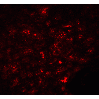 SLC30A8 / ZNT8 Antibody