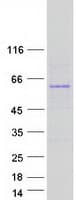 Human TMX3 Protein (Recombinant Myc-DDK (Flag))