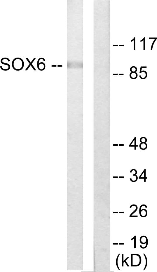 SOX6 Antibody (aa10-59)