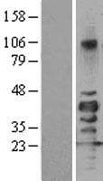SIRT7 / Sirtuin 7 Protein (Over-Expression Lysate Myc-DDK (Flag))