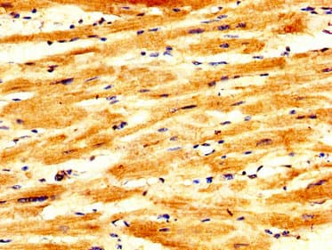 PKP2 / Plakophilin 2 Antibody