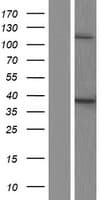 Human ACP5 / TRAP Protein (Over-Expression Lysate Myc-DDK (Flag))
