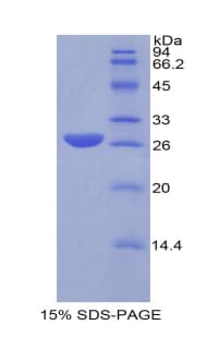 Mouse GSTA1 Protein (Recombinant His)