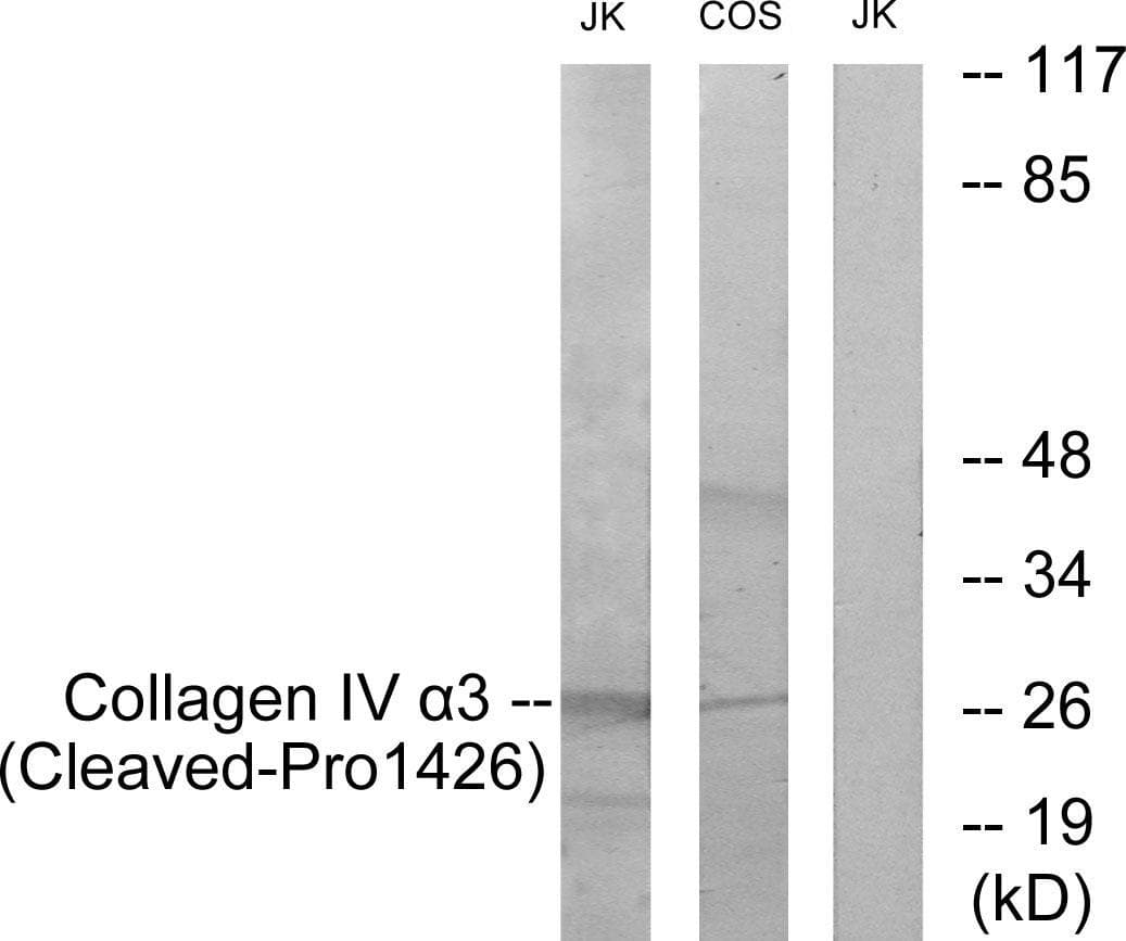 COL4A3 / Tumstatin Antibody (Cleaved-Pro1426)