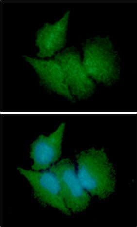 Monoclonal Mouse anti-Human CBR3 Antibody (clone AT7E8, WB)