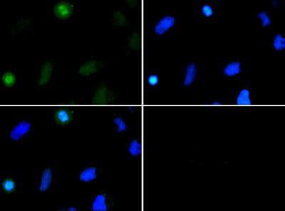 HIST3H3 Antibody (Me2-Lys37)