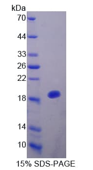 Rat IL25 / IL17E Protein (Recombinant His-T7)