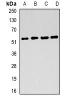 FH / Fumarase / MCL Antibody