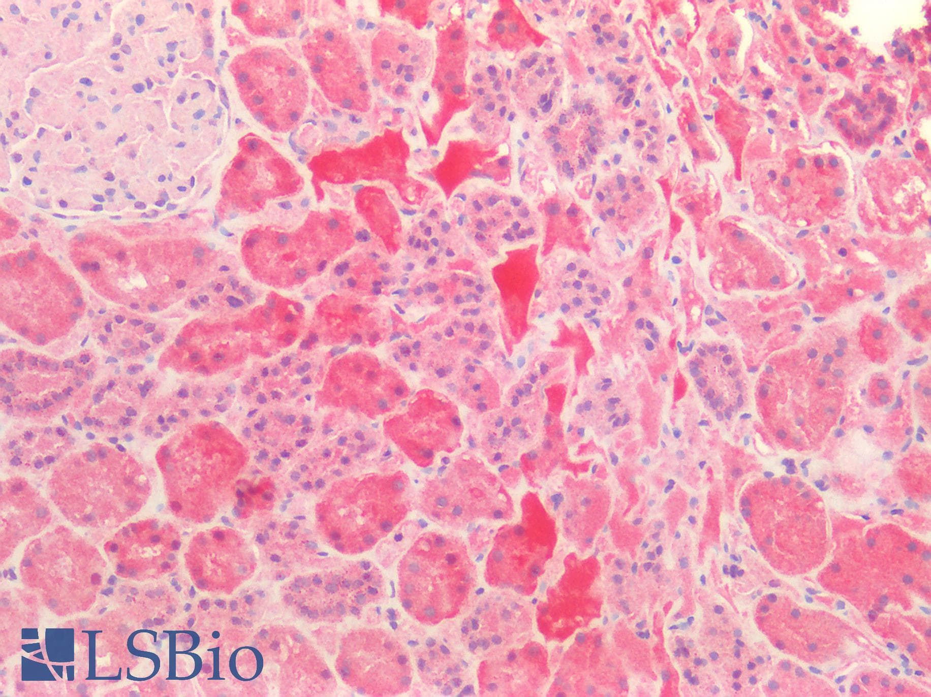 PathPlus™ Polyclonal Rabbit anti-Human HSPA9 / Mortalin / GRP75 Antibody (IHC, IF, WB)