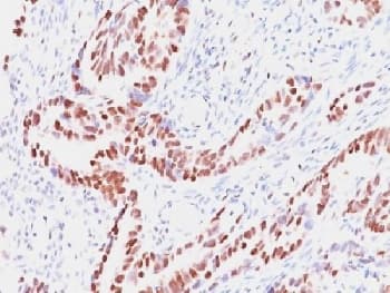 Monoclonal Mouse anti-Human RB1 / Retinoblastoma / RB Antibody (clone SPM353, Azide-free,BSA-free, IHC, WB)