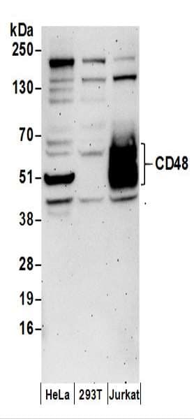 Polyclonal Rabbit anti-Human CD48 Antibody (aa150-200, WB)