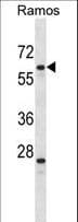 PLRG1 Antibody (aa17-45)