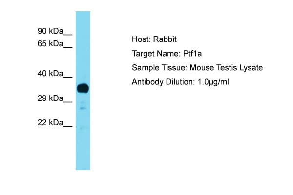 PTF1A Antibody (N-Terminus)