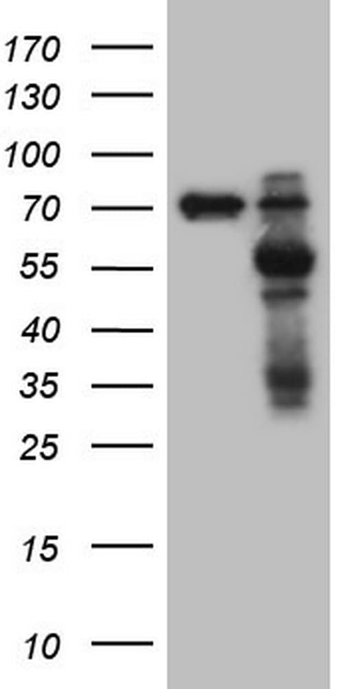 MMP3 Antibody (aa246-477, clone OTI2D6)