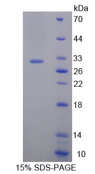 Mouse ETK / BMX Protein (Recombinant His-T7)