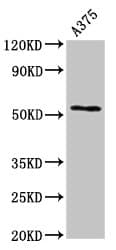 Polyclonal Rabbit anti-Human CPE / Carboxypeptidase E Antibody (WB)