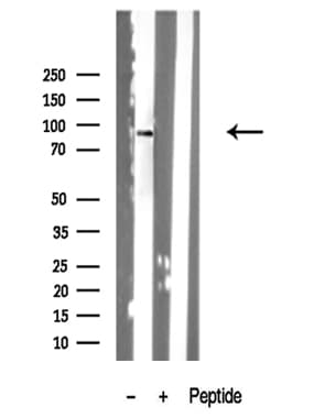 Polyclonal Rabbit anti-Human CENTB1 / ACAP1 Antibody (WB)