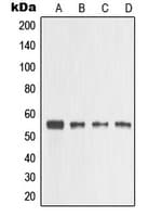 MMP3 Antibody (C-Terminus)