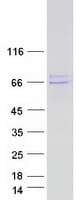 Human ER Alpha / Estrogen Receptor Protein (Recombinant Myc-DDK (Flag))