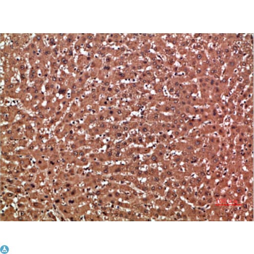 GSTA1 Antibody