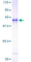 Human SULT1A1 / Sulfotransferase 1A1 Protein (Recombinant GST)