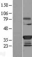 SULT1C2 / Sulfotransferase 1C2 Protein (Over-Expression Lysate Myc-DDK (Flag))