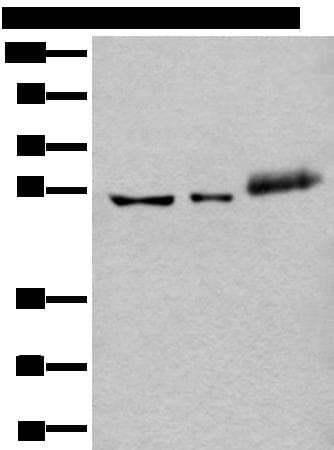 Polyclonal Rabbit anti-Human YY2 Antibody (WB)
