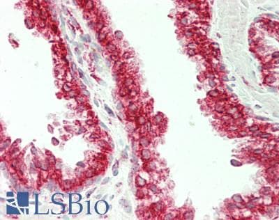 IHC-plus™ Polyclonal Rabbit anti-Human RRBP1 / hES Antibody (aa1490-1540, IHC, WB)
