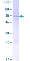 Human ANGPTL8 / Betatrophin Protein (Recombinant GST, N-terminus)