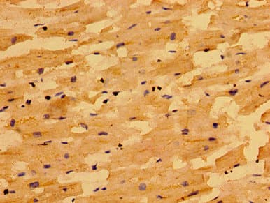 Polyclonal Rabbit anti-Human NIN / Ninein Antibody (IHC)