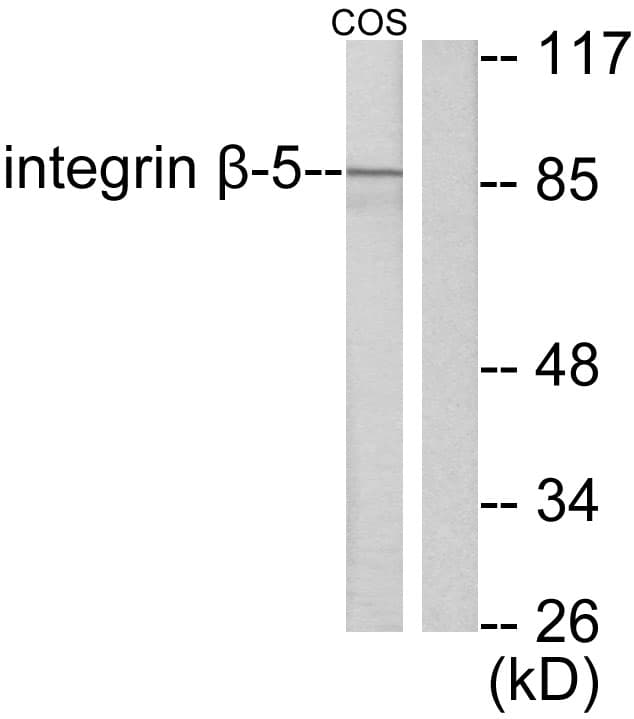 Polyclonal Rabbit anti-Human ITGB5 / Integrin Beta 5 Antibody (aa721-770, WB)