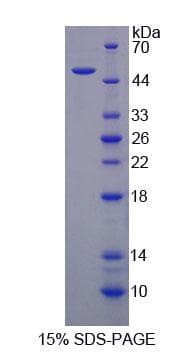Mouse PLIN1 / Perilipin Protein (Recombinant His-GST, N-terminus)