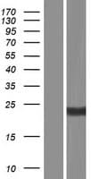 CD8B / CD8 Beta Protein (Over-Expression Lysate Myc-DDK (Flag))