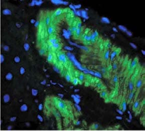 Nitrotyrosine Antibody (clone 39B6)