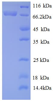 E. coli RECQ / DNA Helicase Protein (Recombinant His)