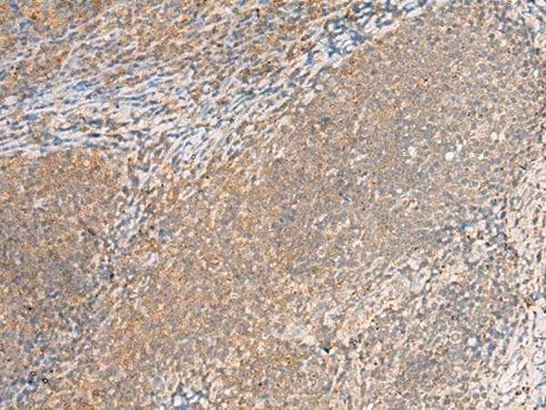Polyclonal Rabbit anti-Human EXD2 Antibody (IHC, WB)