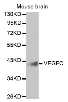 Polyclonal Rabbit anti-Human VEGFC Antibody (IHC, WB)
