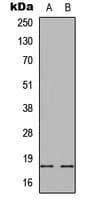 Polyclonal Rabbit anti-Human SNCA / Alpha-Synuclein Antibody (C-Terminus, IHC, IF, WB)