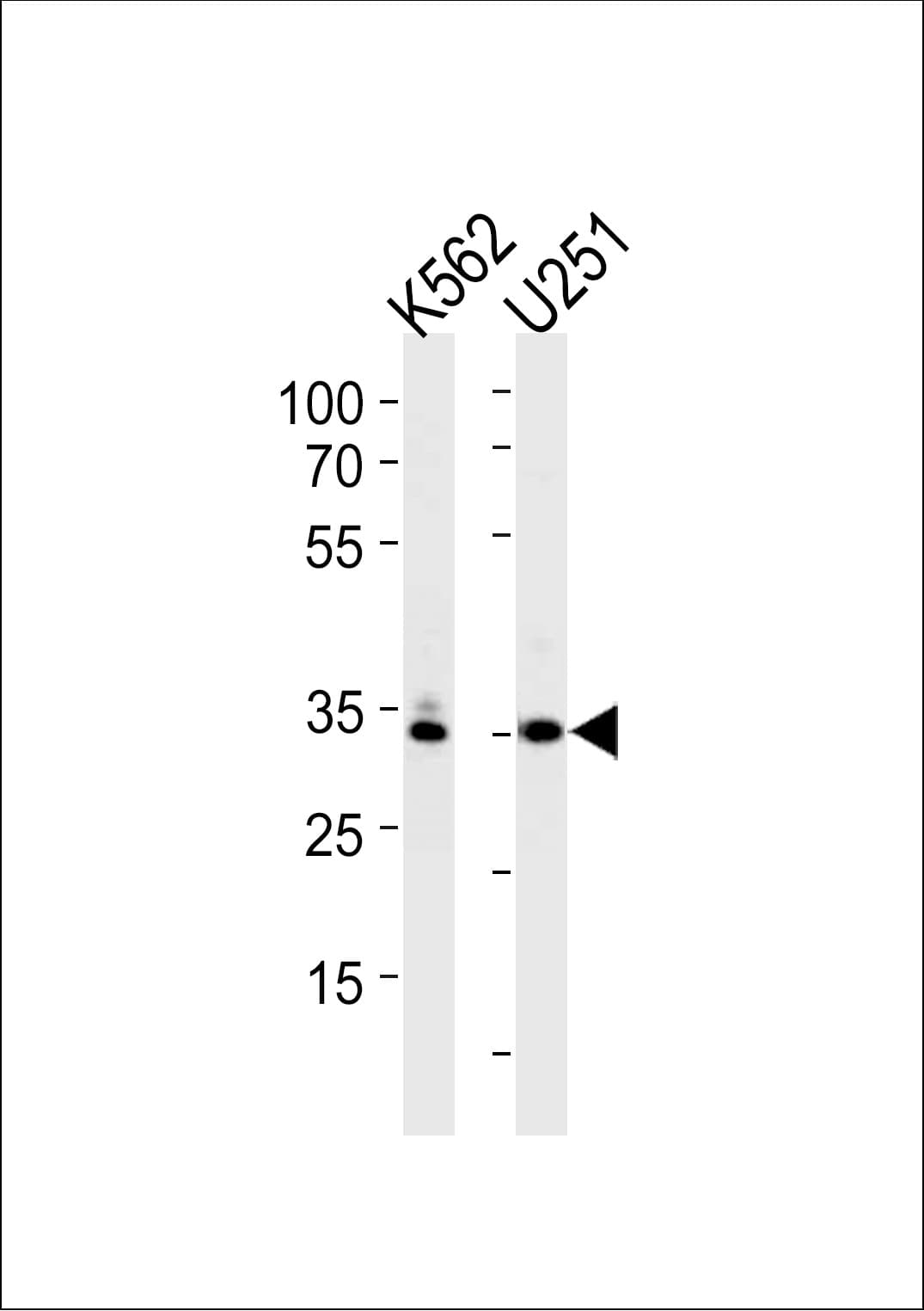 TBP / GTF2D Antibody (aa210-239)