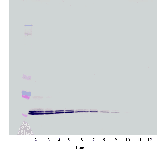 Polyclonal Rabbit anti-Human CXCL16 Antibody (Biotin, WB)