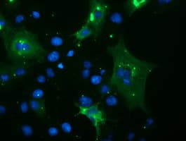 SPRING / TRIM9 Antibody (aa284-669, clone OTI2H3, Carrier-free)
