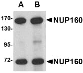 Polyclonal Rabbit anti-Human NUP160 Antibody (IHC, IF, WB)