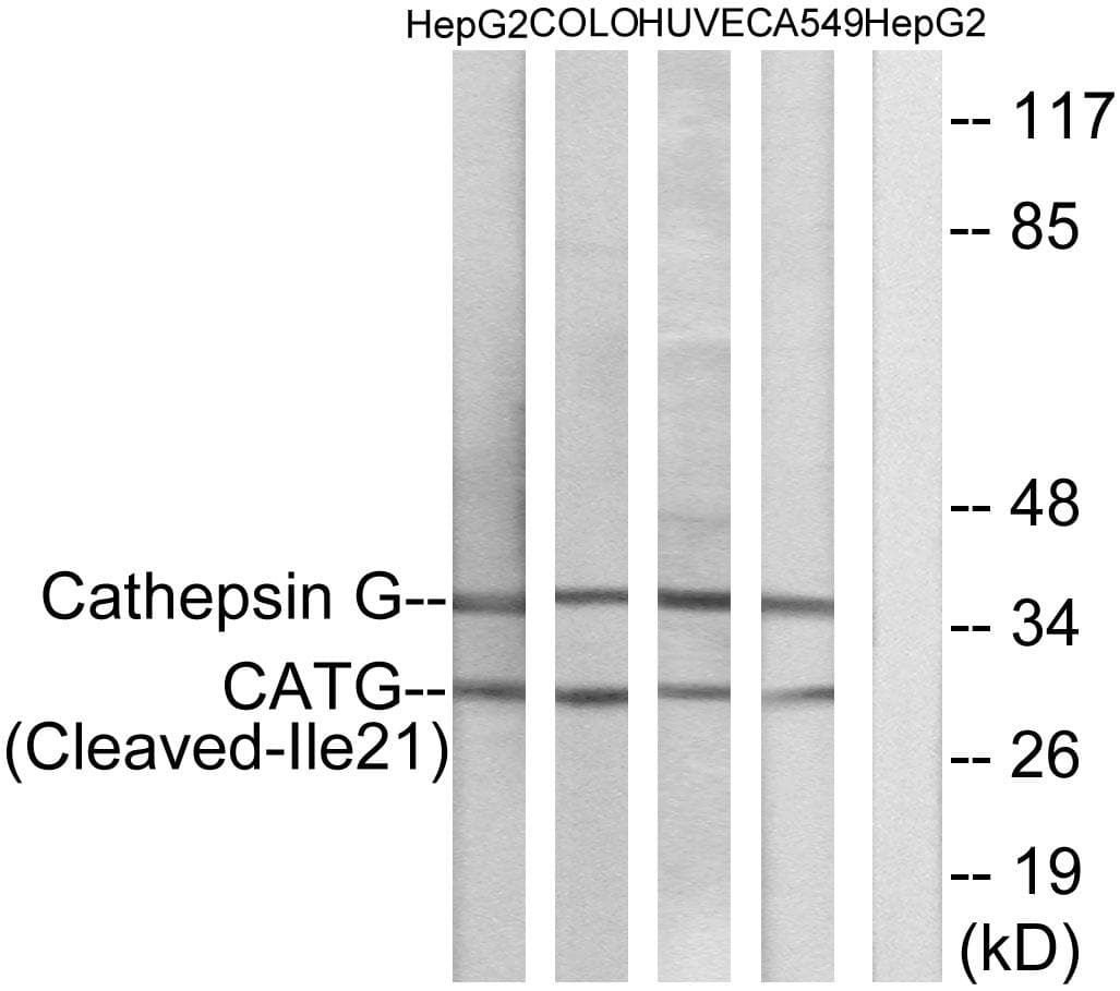 Polyclonal Rabbit anti-Human CTSG / Cathepsin G Antibody (Cleaved-Ile21, WB)