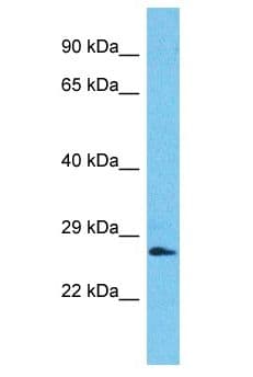 SSX2B Antibody (aa99-148)