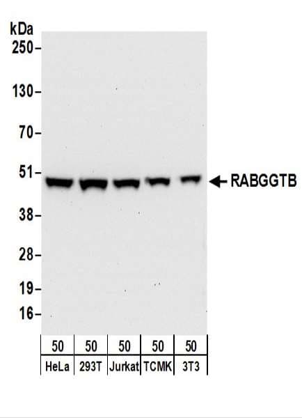 RABGGTB Antibody (aa281-331)