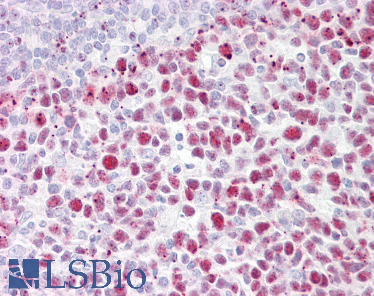 IHC-plus™ LIG1 / DNA Ligase 1 Antibody (aa111-160)
