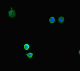 KDM4A / JHDM3A / JMJD2A Antibody