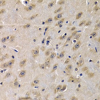 IHC-plus™ Complement C1QA Antibody