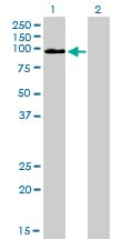 MCC Antibody (clone 1A7)